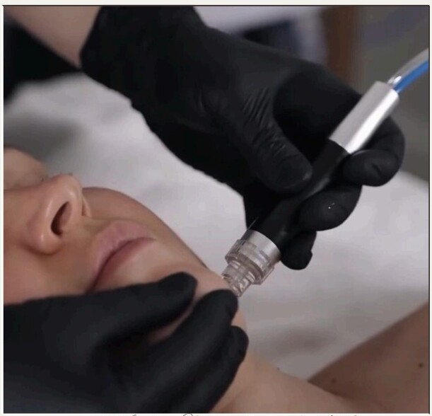 Facials